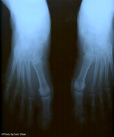 2026-01-11 - X-ray