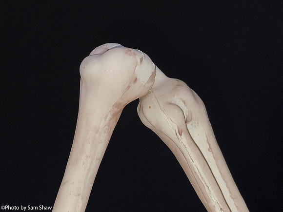 2023-07-16 - Knee
