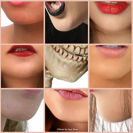 2024-03-02 - Chin